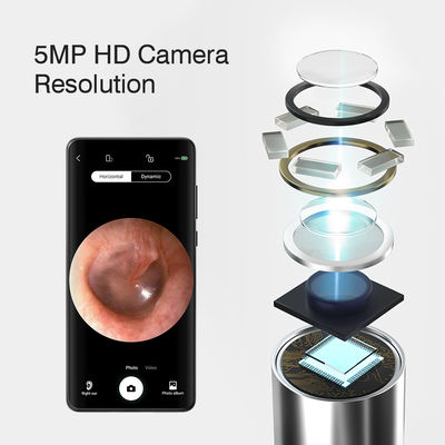 3.9mm HD Digital WiFi Ear Otoscope با عملکرد جهت گیری هوش مصنوعی و اتصال وای فای